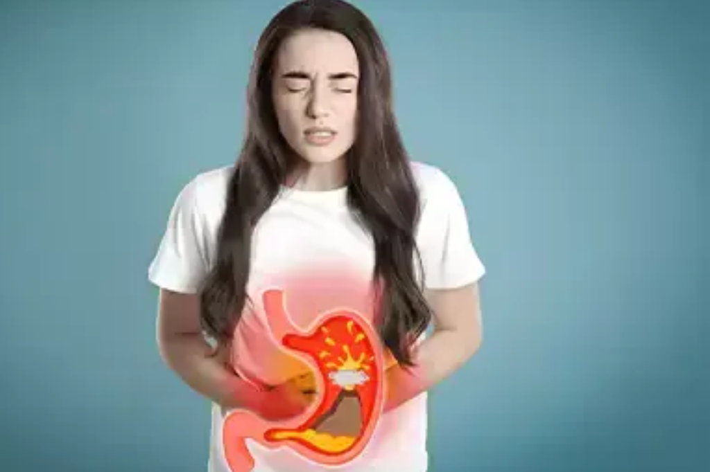 food-allergies